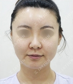 JAYJUN Plastic Surgery,Reviews,Images, Promotions — Korea cost, reviews & before-after | MISOODA
