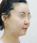 JAYJUN Plastic Surgery,Reviews,Images, Promotions — Korea cost, reviews & before-after | MISOODA