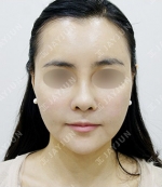 JAYJUN Plastic Surgery,Reviews,Images, Promotions — Korea cost, reviews & before-after | MISOODA