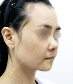 JAYJUN Plastic Surgery,Reviews,Images, Promotions — Korea cost, reviews & before-after | MISOODA