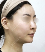JAYJUN Plastic Surgery,Reviews,Images, Promotions — Korea cost, reviews & before-after | MISOODA