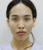 JAYJUN Plastic Surgery,Reviews,Images, Promotions — Korea cost, reviews & before-after | MISOODA