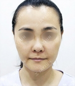 JAYJUN Plastic Surgery,Reviews,Images, Promotions — Korea cost, reviews & before-after | MISOODA