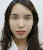 JAYJUN Plastic Surgery,Reviews,Images, Promotions — Korea cost, reviews & before-after | MISOODA