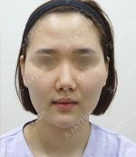 JAYJUN Plastic Surgery,Reviews,Images, Promotions — Korea cost, reviews & before-after | MISOODA
