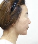 JAYJUN Plastic Surgery,Reviews,Images, Promotions — Korea cost, reviews & before-after | MISOODA