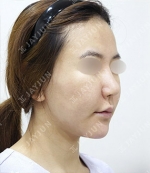 JAYJUN Plastic Surgery,Reviews,Images, Promotions — Korea cost, reviews & before-after | MISOODA