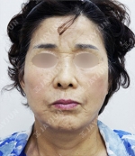 JAYJUN Plastic Surgery,Reviews,Images, Promotions — Korea cost, reviews & before-after | MISOODA