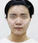JAYJUN Plastic Surgery,Reviews,Images, Promotions — Korea cost, reviews & before-after | MISOODA