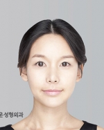 facial contouring