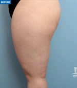 MARBLE Plastic Surgery,Reviews,Images, Promotions — Korea cost, reviews & before-after | MISOODA