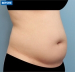 MARBLE Plastic Surgery,Reviews,Images, Promotions — Korea cost, reviews & before-after | MISOODA