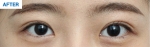 MARBLE Plastic Surgery,Reviews,Images, Promotions — Korea cost, reviews & before-after | MISOODA