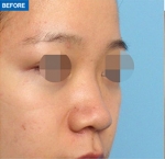 MARBLE Plastic Surgery,Reviews,Images, Promotions — Korea cost, reviews & before-after | MISOODA