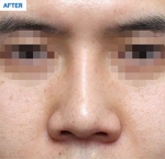 MARBLE Plastic Surgery,Reviews,Images, Promotions — Korea cost, reviews & before-after | MISOODA