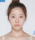MARBLE Plastic Surgery,Reviews,Images, Promotions — Korea cost, reviews & before-after | MISOODA