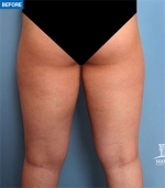 MARBLE Plastic Surgery,Reviews,Images, Promotions — Korea cost, reviews & before-after | MISOODA