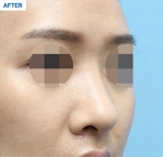 MARBLE Plastic Surgery,Reviews,Images, Promotions — Korea cost, reviews & before-after | MISOODA