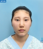 MARBLE Plastic Surgery,Reviews,Images, Promotions — Korea cost, reviews & before-after | MISOODA