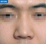 MARBLE Plastic Surgery,Reviews,Images, Promotions — Korea cost, reviews & before-after | MISOODA