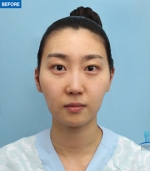MARBLE Plastic Surgery,Reviews,Images, Promotions — Korea cost, reviews & before-after | MISOODA