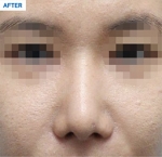 MARBLE Plastic Surgery,Reviews,Images, Promotions — Korea cost, reviews & before-after | MISOODA