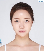 MARBLE Plastic Surgery,Reviews,Images, Promotions — Korea cost, reviews & before-after | MISOODA