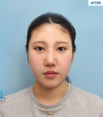 MARBLE Plastic Surgery,Reviews,Images, Promotions — Korea cost, reviews & before-after | MISOODA