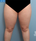 MARBLE Plastic Surgery,Reviews,Images, Promotions — Korea cost, reviews & before-after | MISOODA