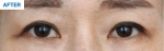 MARBLE Plastic Surgery,Reviews,Images, Promotions — Korea cost, reviews & before-after | MISOODA