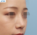 MARBLE Plastic Surgery,Reviews,Images, Promotions — Korea cost, reviews & before-after | MISOODA