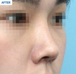 MARBLE Plastic Surgery,Reviews,Images, Promotions — Korea cost, reviews & before-after | MISOODA