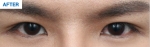 MARBLE Plastic Surgery,Reviews,Images, Promotions — Korea cost, reviews & before-after | MISOODA