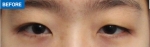 MARBLE Plastic Surgery,Reviews,Images, Promotions — Korea cost, reviews & before-after | MISOODA