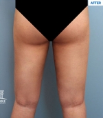 MARBLE Plastic Surgery,Reviews,Images, Promotions — Korea cost, reviews & before-after | MISOODA