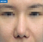 MARBLE Plastic Surgery,Reviews,Images, Promotions — Korea cost, reviews & before-after | MISOODA
