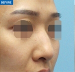 MARBLE Plastic Surgery,Reviews,Images, Promotions — Korea cost, reviews & before-after | MISOODA