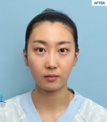 MARBLE Plastic Surgery,Reviews,Images, Promotions — Korea cost, reviews & before-after | MISOODA