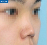 MARBLE Plastic Surgery,Reviews,Images, Promotions — Korea cost, reviews & before-after | MISOODA
