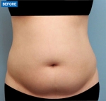 MARBLE Plastic Surgery,Reviews,Images, Promotions — Korea cost, reviews & before-after | MISOODA