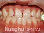 dental