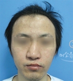 MISOU Plastic Surgery, Reviews,Images, Promotions — Korea cost, reviews & before-after | MISOODA