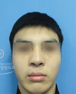MISOU Plastic Surgery, Reviews,Images, Promotions — Korea cost, reviews & before-after | MISOODA