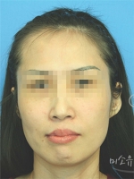 MISOU Plastic Surgery, Reviews,Images, Promotions — Korea cost, reviews & before-after | MISOODA