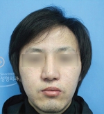 MISOU Plastic Surgery, Reviews,Images, Promotions — Korea cost, reviews & before-after | MISOODA