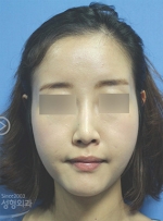 MISOU Plastic Surgery, Reviews,Images, Promotions — Korea cost, reviews & before-after | MISOODA