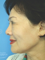 MISOU Plastic Surgery, Reviews,Images, Promotions — Korea cost, reviews & before-after | MISOODA