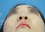 MISOU Plastic Surgery, Reviews,Images, Promotions — Korea cost, reviews & before-after | MISOODA