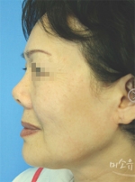 MISOU Plastic Surgery, Reviews,Images, Promotions — Korea cost, reviews & before-after | MISOODA