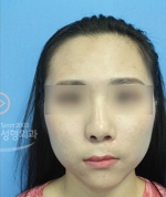 MISOU Plastic Surgery, Reviews,Images, Promotions — Korea cost, reviews & before-after | MISOODA